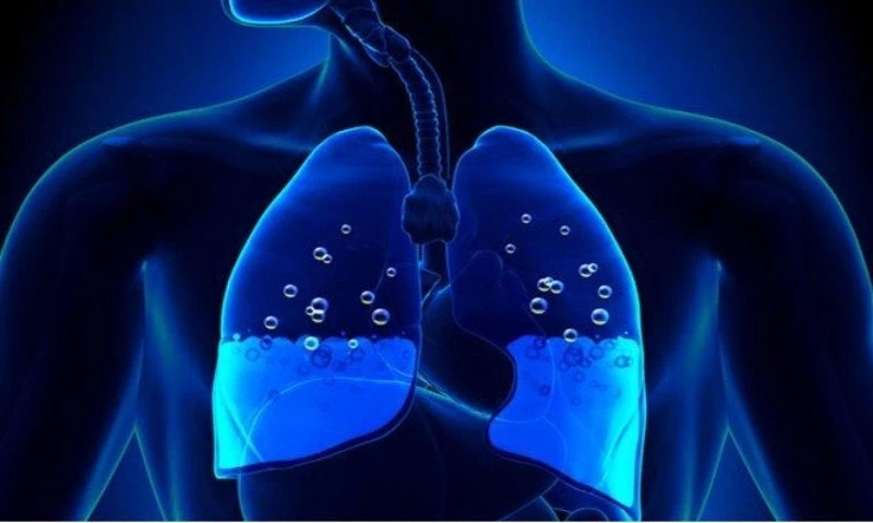 Πνευμονικό οίδημα: Πώς να προφυλαχθείτε από τους κινδύνους